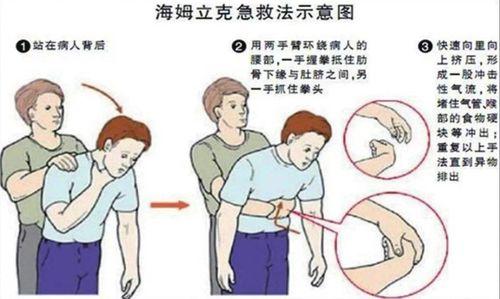 成人吞咽障碍手法视频,实用技巧与案例分析